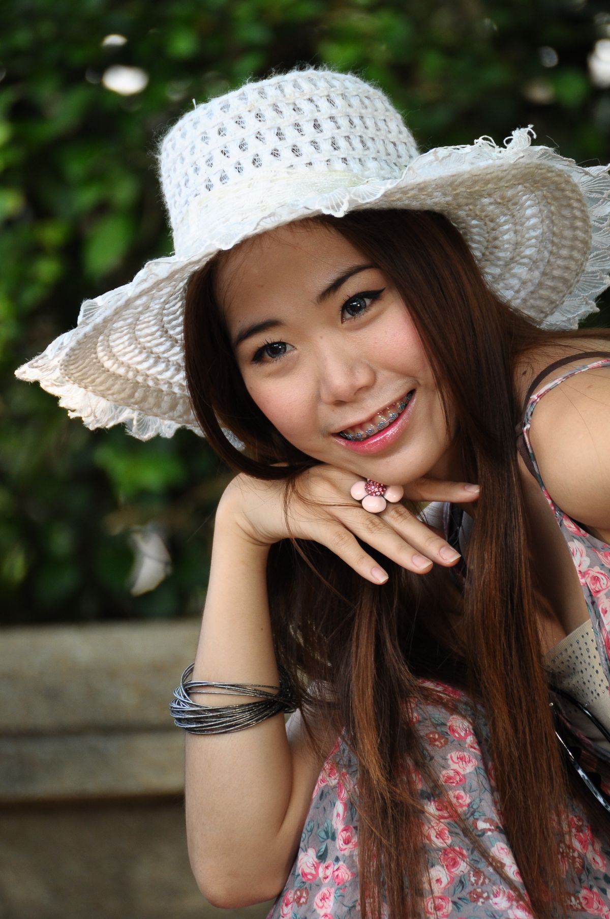 Nụ cười sau khi chỉnh nha
